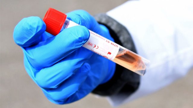 Azərbaycanda koronavirusdan 43 nəfər də öldü - GÜNÜN STATİSTİKASI