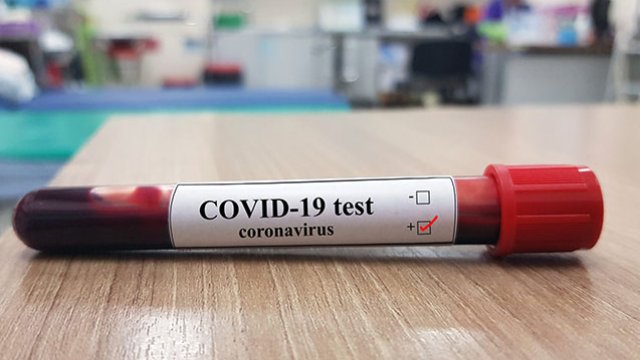 Koronavirusa yoluxanların sayı azaldı - Günün statistikası