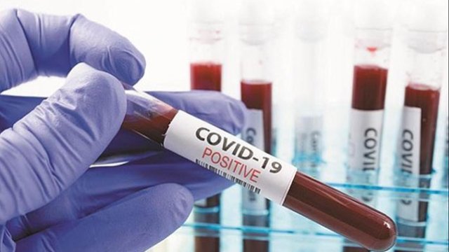 Azərbaycandan koronavirusdan 45 nəfər də öldü - GÜNÜN STATİSTİKASI