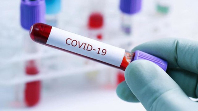 Azərbaycanda koronavirusdan 46 nəfər də vəfat etdi - GÜNÜN STATİSTİKASI