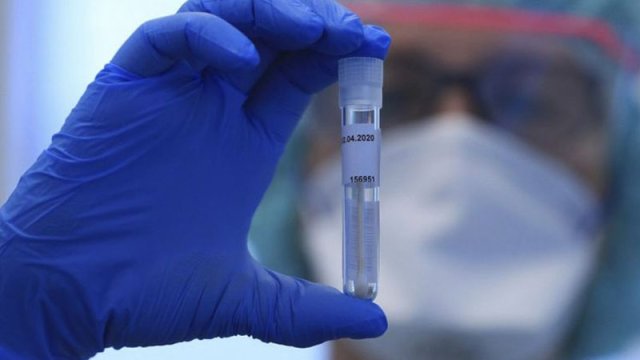 Koronavirusla bağlı son məlumat AÇIQLANDI