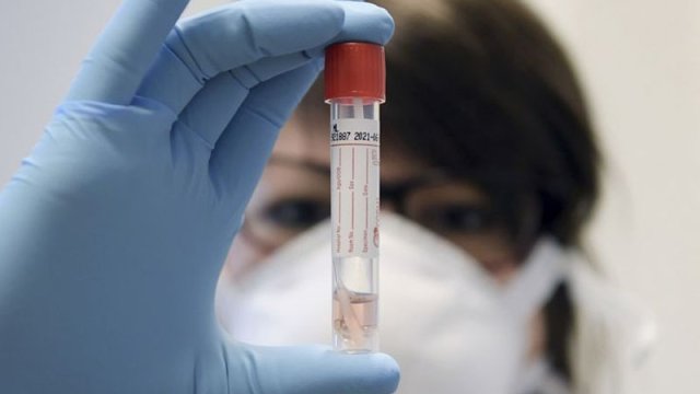 Vaksinin insanda yaratdığı immunitet müddəti minimum 1 ildir - TƏBİB