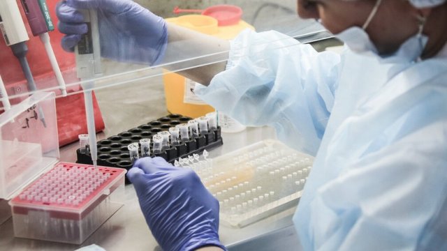 Dünyada koronavirusa yoluxanların sayı 123 milyonu ötdü