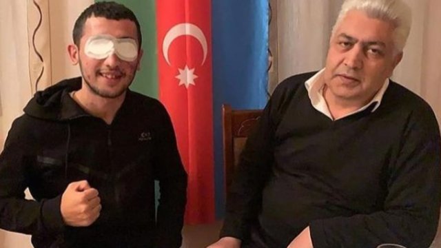 Hər iki gözünü itirən qazinin atası vəfat etdi - FOTO
