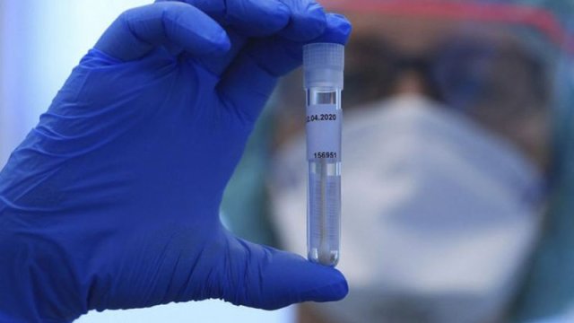 Günlük yoluxma sayı AÇIQLANDI