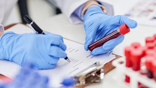 Koronavirusa yoluxanların sayı azalır -xa0Günün statistikası