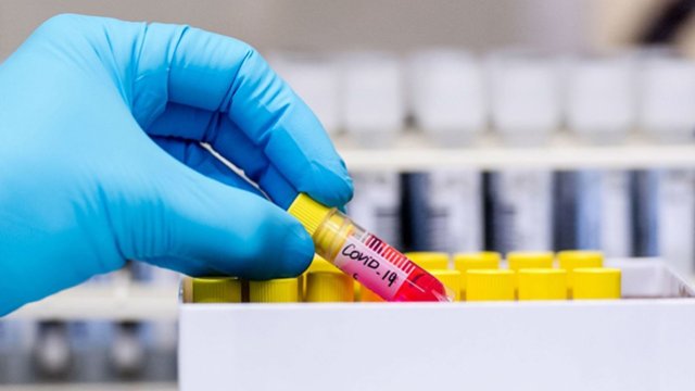 Koronavirusa yeni yoluxanların sayı AÇIQLANDI