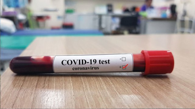 Koronavirusdan ölənlərin sayı artdı - Günün STATİSTİKASI