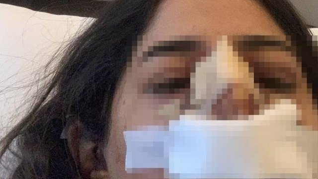 Gənc qızı tanınmaz hala salan cərrah onu lağa qoydu - FOTO