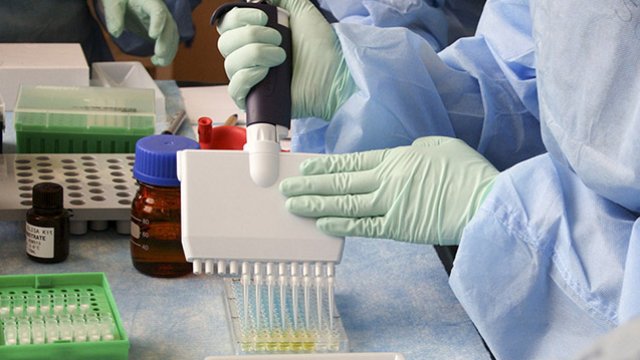 Bütün ştamlara qarşı antitel aşkar olundu