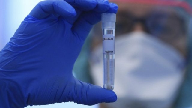 Azərbaycanda koronavirusdan daha 45 nəfər öldü - 3 759 yeni yoluxma