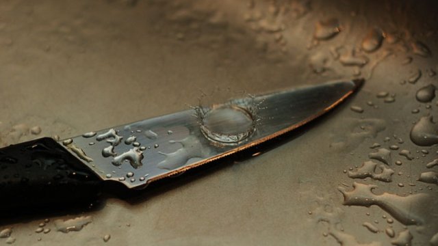 Gəncədə 20 yaşlı qadın bıçaqlandı