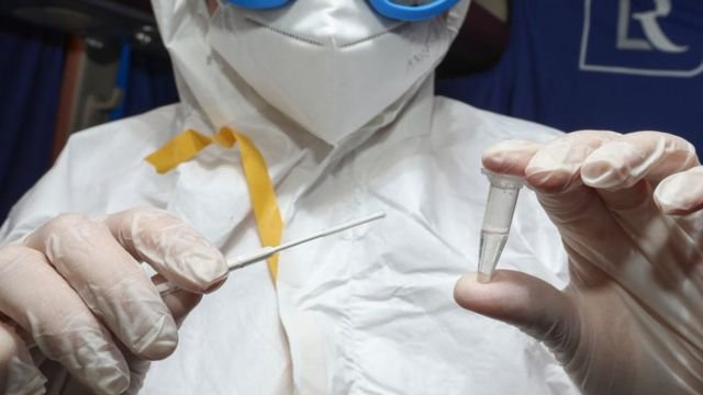 ADNSU-da bir qrupda virus aşkarlandı