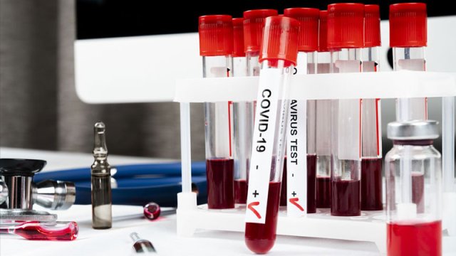 COVID-19-un təhlükəli yeni ştamı aşkarlandı: Bu şəxslər daha tez yoluxur