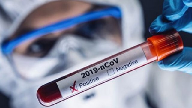 Azərbaycanda daha 306 nəfər koronavirusa yoluxub, 11 nəfər vəfat edib