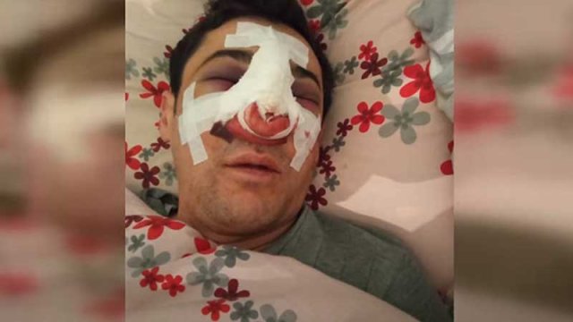 Bakıda avtobus sürücüsü döyüldü - VİDEO