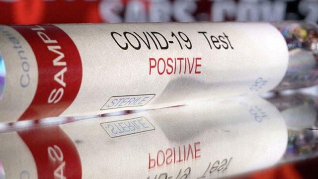 “Omikron”un iki yeni variantı aşkarlandı: 