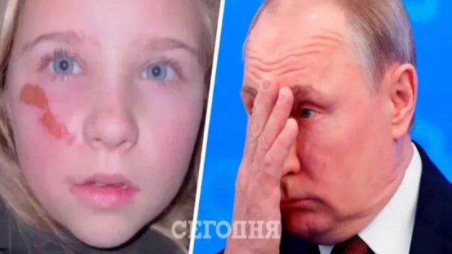 Ukrayna uşaqlarından Putinə MÜRACİƏT -VİDEO