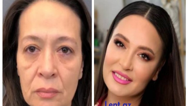 54 yaşlı Əməkdar artistimiz üzündə dəyişiklik etdirdi - FOTOLAR