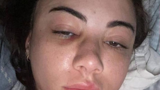 Azərbaycanlı müğənni qəza törətdi, üzü tanınmaz hala düşdü - FOTOlar