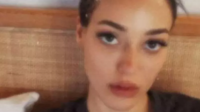 Məşhur aktrisanın serial çəkilişi zamanı başı yarıldı (FOTO)