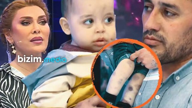 55 min pul yığılan 1 yaşlı uşaq vəfat etdi - VİDEO