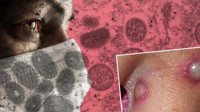 Hamını qorxuya salan yeni virus: 