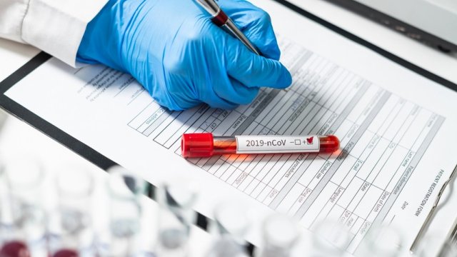 Daha 51 nəfər koronavirusa yoluxub, 3 nəfər ölüb