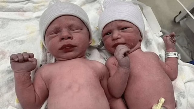 Tibb tarixində görünməmiş hadisə: 30 yaşlı əkiz uşaqlar dünyaya gəldi