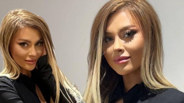 İlqarənin yeni görünüşü təəccübləndirdi - FOTO