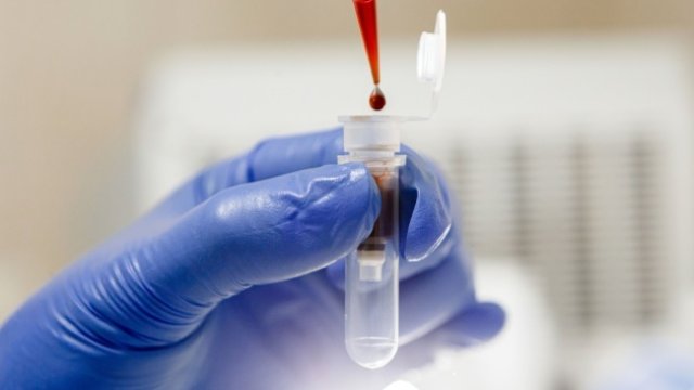 Bu ölkənin paytaxtında üç nəfərdə bubon vəbası aşkarlandı