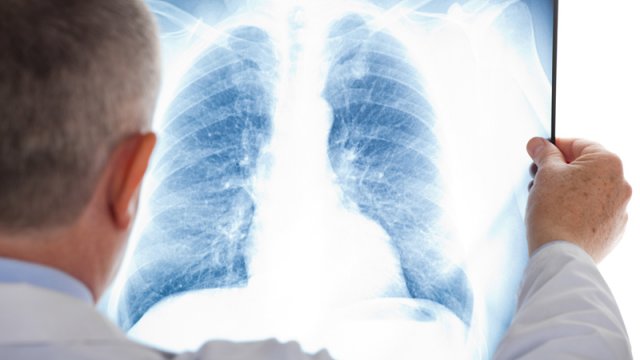 Alimlər insanın bioloji yaşını hesablamaq üçün yeni üsul tapdı