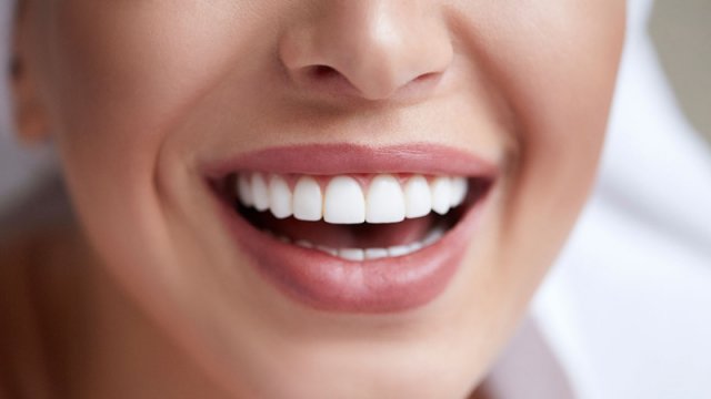 Diş həkimi soda ilə dişləri ağartmağın təhlükələrindən danışdı