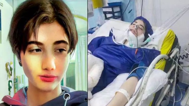 İranda hicab taxmadığı üçün polisin döydüyü qız öldü - FOTO