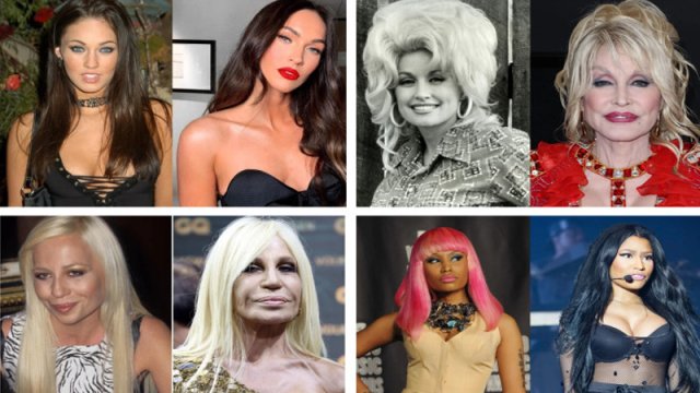 Ən çox plastik əməliyyat etdirmiş ulduzlar - SİYAHI/FOTO