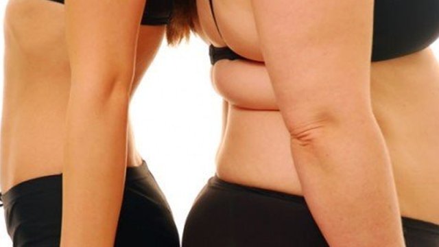 Piylənmə artıq pandemiya xarakteri alıb - Həkim