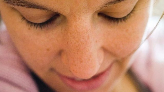 Dəri ləkəsi xərçəngə səbəb ola bilir - 5 əlaməti var