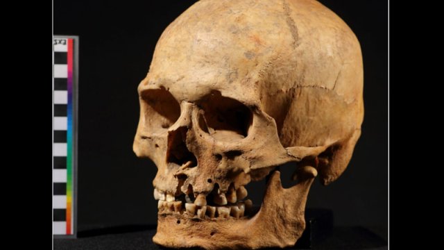 Alimlər insanların və dinozavrların kəllələrindəki dəliklərin mənşəyini tapdı