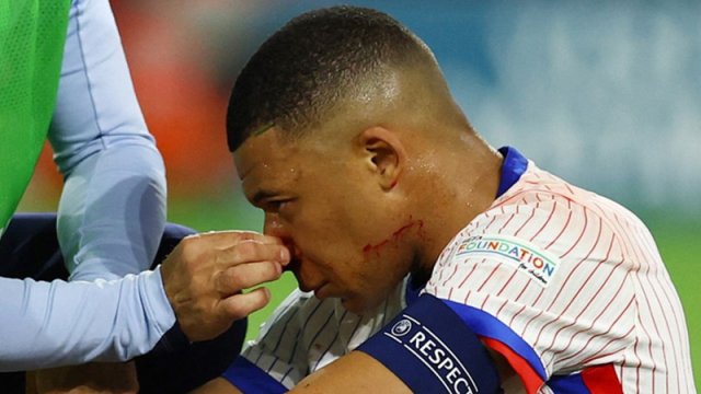 Mbappe AVRO-2024-ün qrup mərhələsində oynaya bilməyəcək