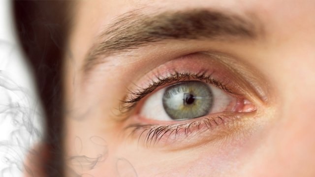 Arıqlamaq üçün dərmanların təhlükəli yan təsirləri tapıldı