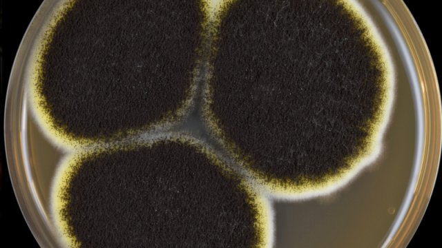 Çində yeni yüksək yoluxucu və dərmana davamlı infeksiya tapıldı