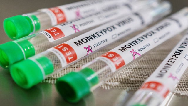 
Meymunçiçəyi virusuna qarşı antibiotiklərdən istifadə oluna bilər? - RƏSMİ