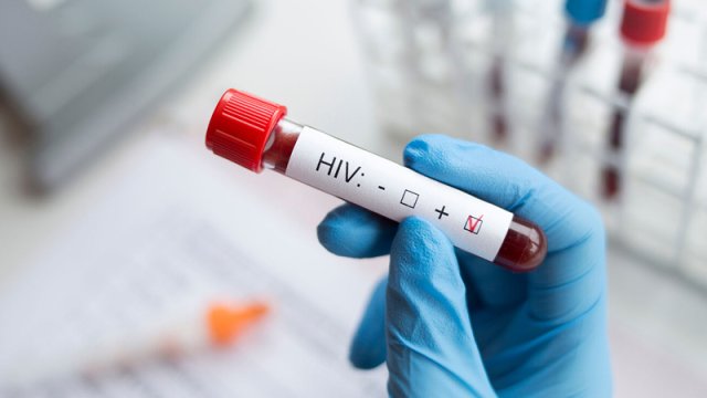 Yeni xərçəng dərmanı HIV-i tamamilə sağalda bilər - Alimlər