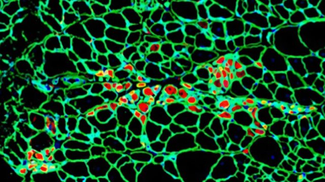 İnsan hüceyrələri səsləri eşidir