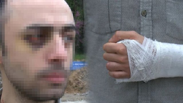 Türkiyədə azərbaycanlı tələbəni döyüb videoya çəkənlərə ağır cəza - FOTO