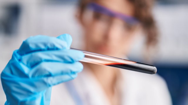 Bu yolla erkən doğuşu dörd ay əvvəldən proqnozlaşdırmaq olar