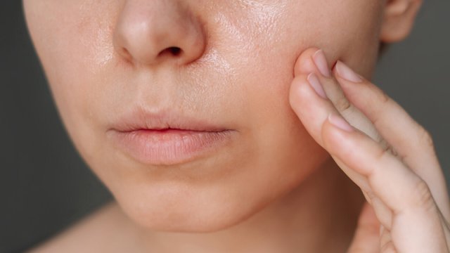 Həkim yayda yağlı dəriyə qulluqda səhvləri açıqladı