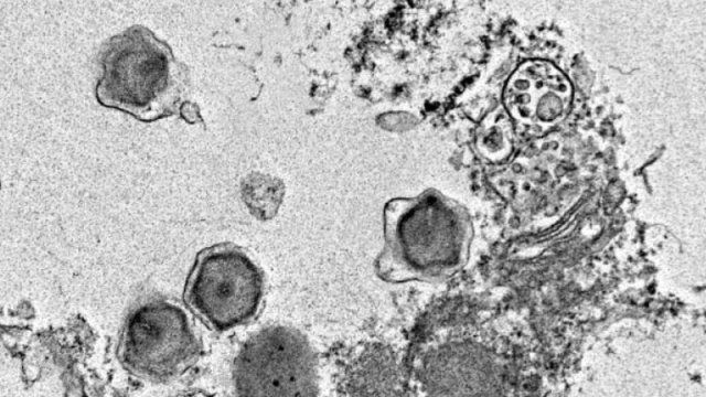 Okeanda tapılan 230 yeni nəhəng virus insan sağlamlığına təsir edə bilər - TƏDQİQAT