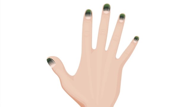 Dırnaqlarınızda yaşıl ləkələr görürsünüzsə diqqətli olun: Yaşıl dırnaq sindromu nədir?