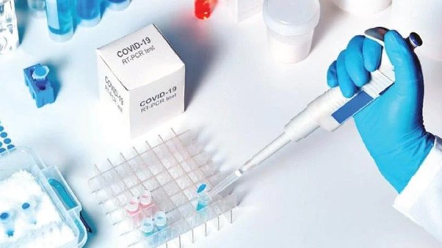 İnnovasiya və Təchizat Mərkəzi 11 milyonluq test alır